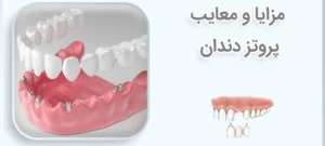 مزایا و عوارض پروتز متحرک دندان