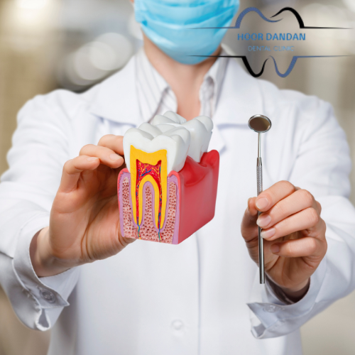 پروتز متحرک